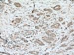 RALA Antibody in Immunohistochemistry (Paraffin) (IHC (P))