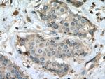 RALA Antibody in Immunohistochemistry (Paraffin) (IHC (P))