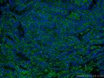 RALB Antibody in Immunohistochemistry (Paraffin) (IHC (P))