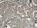 ATG9A Antibody in Immunohistochemistry (Paraffin) (IHC (P))