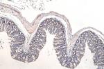 DVL2 Antibody in Immunohistochemistry (Paraffin) (IHC (P))