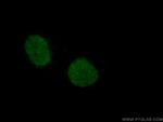 HOXA7 Antibody in Immunocytochemistry (ICC/IF)