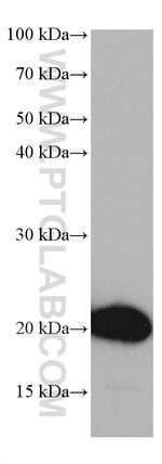 HOXA7 Antibody in Western Blot (WB)