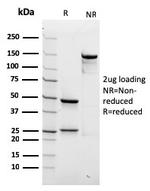 Spectrin beta III (SPTBN2) Antibody in SDS-PAGE (SDS-PAGE)