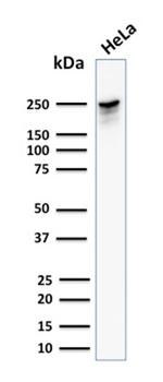 Spectrin beta III (SPTBN2) Antibody in Western Blot (WB)