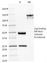 Spectrin beta III (SPTBN2) Antibody in SDS-PAGE (SDS-PAGE)