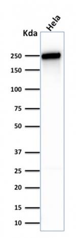 Spectrin beta III (SPTBN2) Antibody in Western Blot (WB)