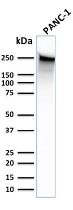 Spectrin beta III (SPTBN2) Antibody in Western Blot (WB)