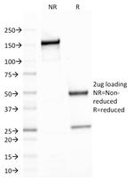 Spectrin beta III (SPTBN2) Antibody in SDS-PAGE (SDS-PAGE)