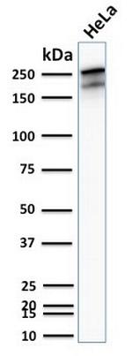 Spectrin beta III (SPTBN2) Antibody in Western Blot (WB)