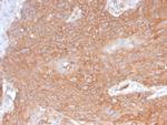 Spectrin beta III (SPTBN2) Antibody in Immunohistochemistry (Paraffin) (IHC (P))