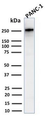 Spectrin beta III (SPTBN2) Antibody in Western Blot (WB)