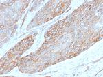 Spectrin beta III (SPTBN2) Antibody in Immunohistochemistry (Paraffin) (IHC (P))