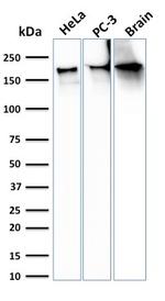 Spectrin beta III (SPTBN2) Antibody in Western Blot (WB)