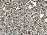 PI3 Kinase p110 Beta Antibody in Immunohistochemistry (Paraffin) (IHC (P))