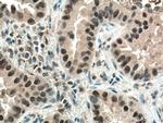 PI3 Kinase p110 Beta Antibody in Immunohistochemistry (Paraffin) (IHC (P))