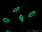 SFPQ Antibody in Immunocytochemistry (ICC/IF)