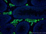 STAR Antibody in Immunohistochemistry (PFA fixed) (IHC (PFA))