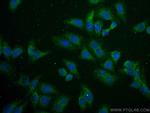 FSH beta Antibody in Immunocytochemistry (ICC/IF)