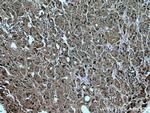 FSH beta Antibody in Immunohistochemistry (Paraffin) (IHC (P))