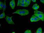 FLNA Antibody in Immunocytochemistry (ICC/IF)