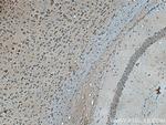 VSNL1 Antibody in Immunohistochemistry (Paraffin) (IHC (P))