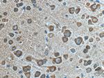 VSNL1 Antibody in Immunohistochemistry (Paraffin) (IHC (P))