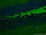 STXBP1 Antibody in Immunohistochemistry (PFA fixed) (IHC (PFA))