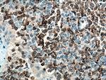 RIAM/APBB1IP Antibody in Immunohistochemistry (Paraffin) (IHC (P))