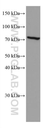 FGL2 Antibody in Western Blot (WB)