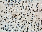 DHX9 Antibody in Immunohistochemistry (Paraffin) (IHC (P))