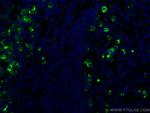 CD138/Syndecan-1 Antibody in Immunohistochemistry (Paraffin) (IHC (P))