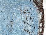 CD138/Syndecan-1 Antibody in Immunohistochemistry (Paraffin) (IHC (P))