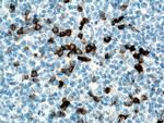 CD138/Syndecan-1 Antibody in Immunohistochemistry (Paraffin) (IHC (P))