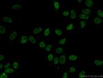 HDAC2 Antibody in Immunocytochemistry (ICC/IF)