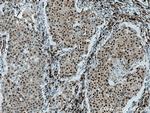 HDAC2 Antibody in Immunohistochemistry (Paraffin) (IHC (P))