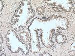 HUS1 Antibody in Immunohistochemistry (Paraffin) (IHC (P))