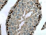 DMC1 Antibody in Immunohistochemistry (Paraffin) (IHC (P))