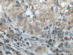 GPI Antibody in Immunohistochemistry (Paraffin) (IHC (P))