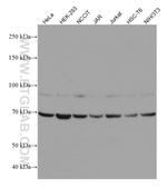 ECD Antibody in Western Blot (WB)