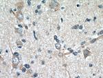 GAS1 Antibody in Immunohistochemistry (Paraffin) (IHC (P))