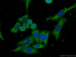 Cytohesin 2 Antibody in Immunocytochemistry (ICC/IF)