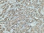 HSF1 Antibody in Immunohistochemistry (Paraffin) (IHC (P))