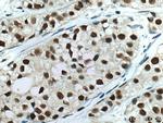 HSF1 Antibody in Immunohistochemistry (Paraffin) (IHC (P))