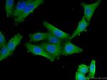 VDR Antibody in Immunocytochemistry (ICC/IF)