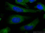 NUFIP2 Antibody in Immunocytochemistry (ICC/IF)