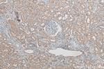 YES1 Antibody in Immunohistochemistry (Paraffin) (IHC (P))