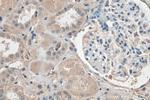 YES1 Antibody in Immunohistochemistry (Paraffin) (IHC (P))