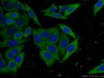 EIF4G1 Antibody in Immunocytochemistry (ICC/IF)