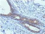 BRCA1 (Breast Marker) Antibody in Immunohistochemistry (Paraffin) (IHC (P))